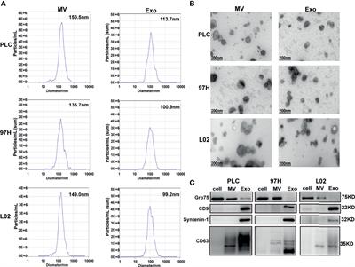 Cancer Cell-Derived Exosomes Promote HCC Tumorigenesis Through Hedgehog Pathway